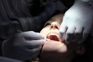 fillings and crowns