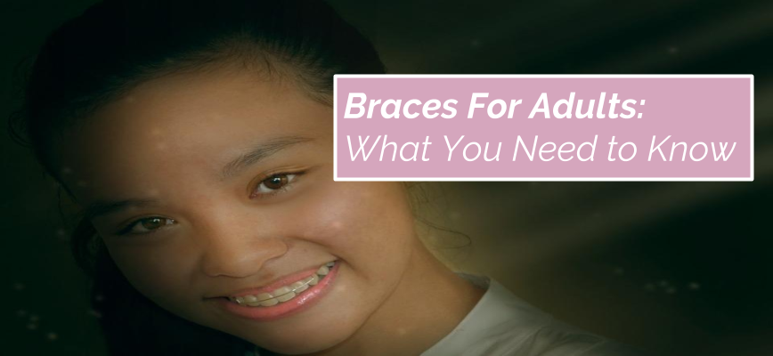 braces-for-adults-what-you-need-to-know